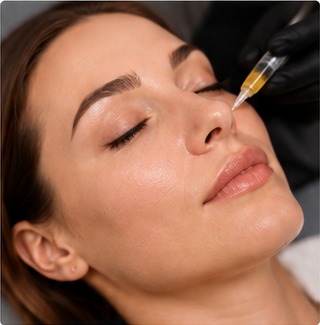 PRF EZ Gel injection along the side of the nose