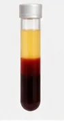 viva pp prf tube